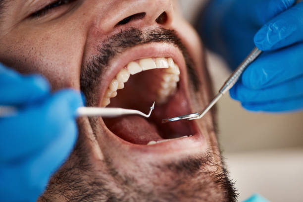 Best Knocked-Out Tooth Emergency  in Gloucester Courthouse, VA